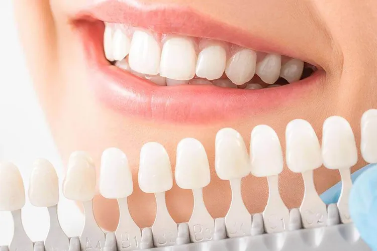 Zirkonyum Diş Renk Skalası